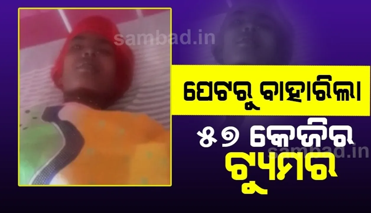  ରାଜ୍ୟପାଇଁ ଗୌରବ ଆଣିଲେ ଖୋର୍ଦ୍ଧା କୁହୁଡି ସାଇ ସେବା ସଦନର ଚିକିତ୍ସକ, ମହିଳାଙ୍କ ପେଟରୁ ବାହାରିଲା ୫୭ କେଜିର ଟ୍ୟୁମର୍