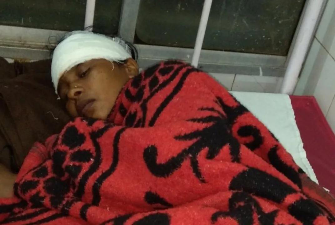 ସ୍ୱାମୀର ଟାଙ୍ଗିଆ ଚୋଟରେ ସ୍ତ୍ରୀ ଗୁରୁତର