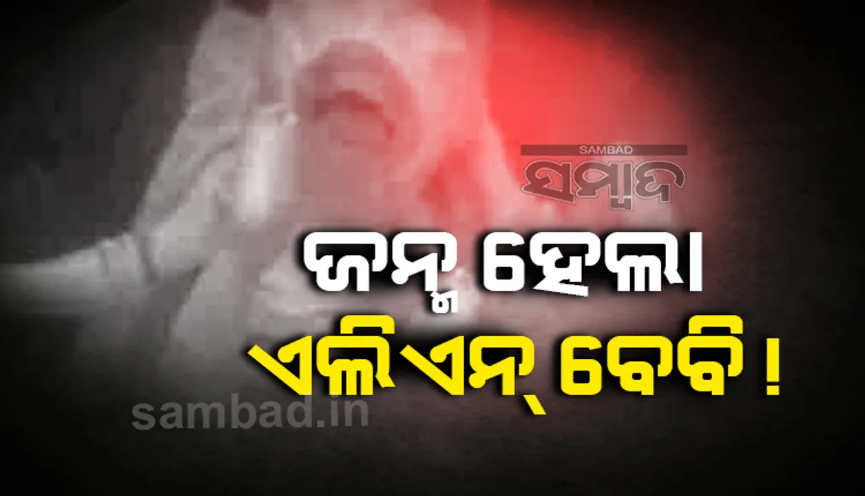  ବିଚିତ୍ର ନବଜାତ ଶିଶୁକୁ ଦେଖି ଲୋକେ ନାମ ଦେଲେ, ‘ଏଲିଏନ ବେବି’