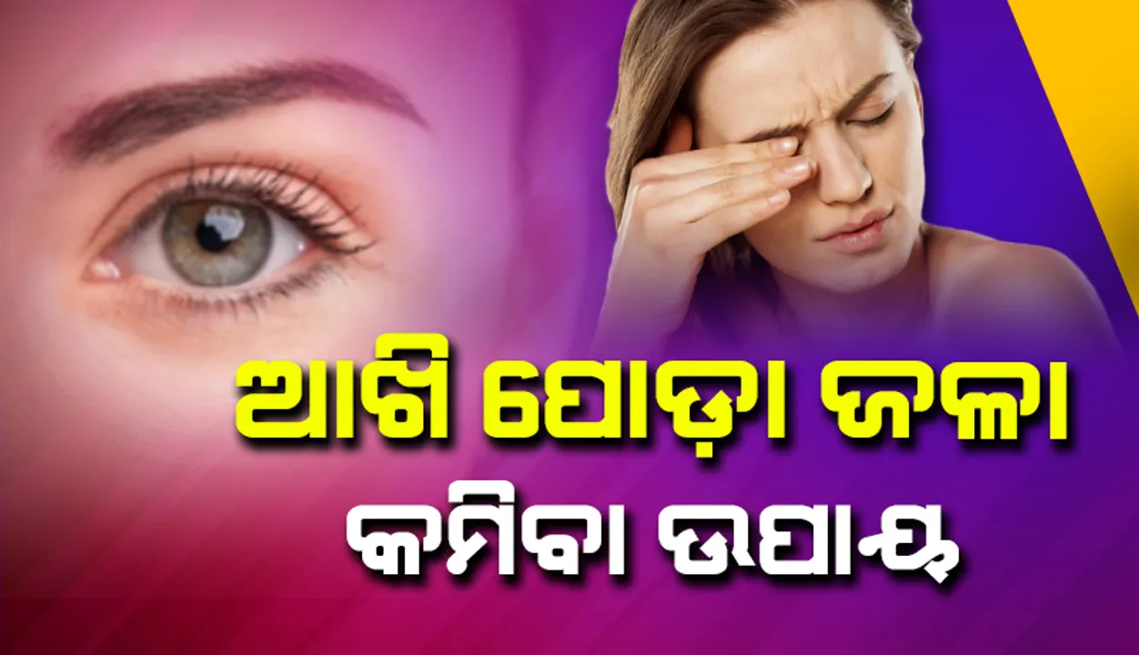  ଏଭଳି କଲେ କମିଥାଏ ଆଖି ପୋଡ଼ା ଜଳା, ଆପଣାନ୍ତୁ ଏହି ସବୁ ଘରୋଇ ଉପାୟ