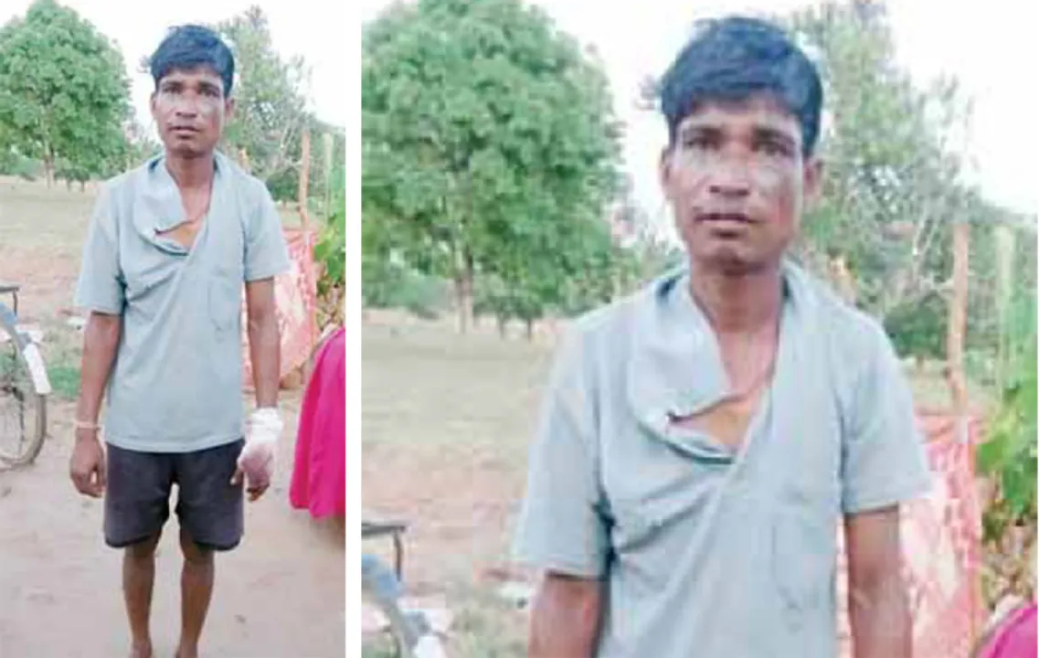  ପତ୍ନୀ ପାଇଁ ଭାଲୁ ସହ ଲଢ଼ିଲେ ଯୁବକ; ଛିଣ୍ଡିଯାଇଛି ଆଙ୍ଗୁଠି, ଅର୍ଥ ନଥିବାରୁ ହୋ‌ଇପାରିଲାନି ସଂପୂର୍ଣ୍ଣ ଚିକିତ୍ସା