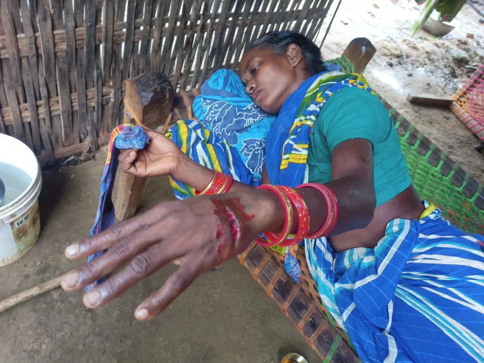 ସମ୍ବଲପୁର: ଭାଲୁ ଆକ୍ରମଣରେ ୨ ଗୁରୁତର