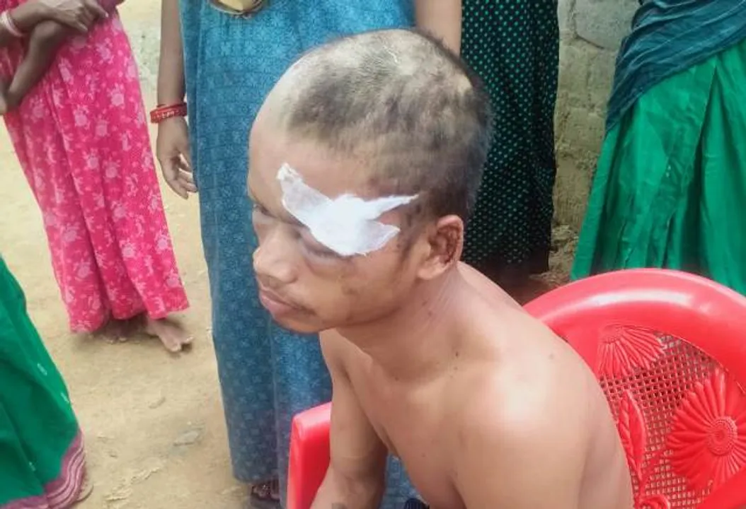  ପ୍ରେମିକକୁ ମାଡ଼ ମାରି ଚୁଟି କାଟିଦେଲେ ନାବାଳିକାର ପରିବାରବର୍ଗ