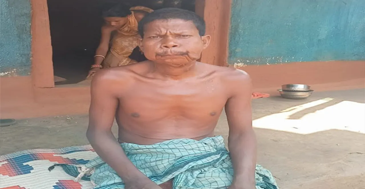  ରୁଦନ ପାଇଲେ ନୂଆ ଜୀବନ, ବଦଳିଲା ରୂପ