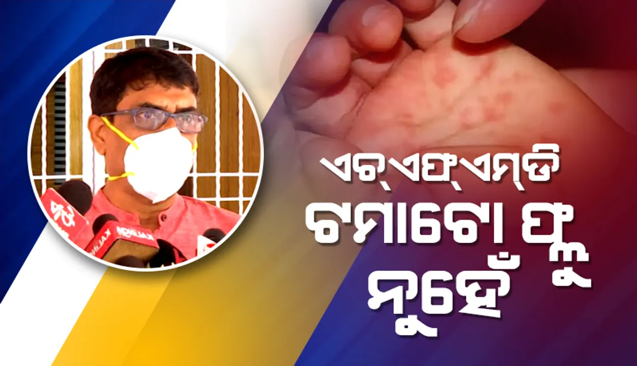  ଏଚଏଫଏମଡି ପାଇଁ ଆତଙ୍କିତ ହେବାର ଆବଶ୍ୟକତା ନାହିଁ: ସ୍ବାସ୍ଥ୍ୟ ନିର୍ଦ୍ଦେଶକ ବିଜୟ ମହାପାତ୍ର
