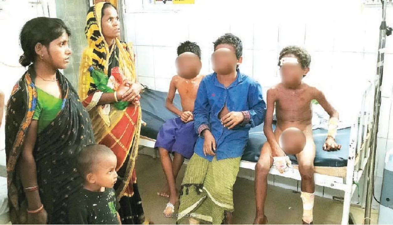  ସୂତୁଲି ବୋମା ଫୁଟି ୪ ଶିଶୁ ଆହତ; ଦେହସାରା ଖଣ୍ଡିଆ, ଜଣଙ୍କ ଆଖି କ୍ଷତିଗ୍ରସ୍ତ