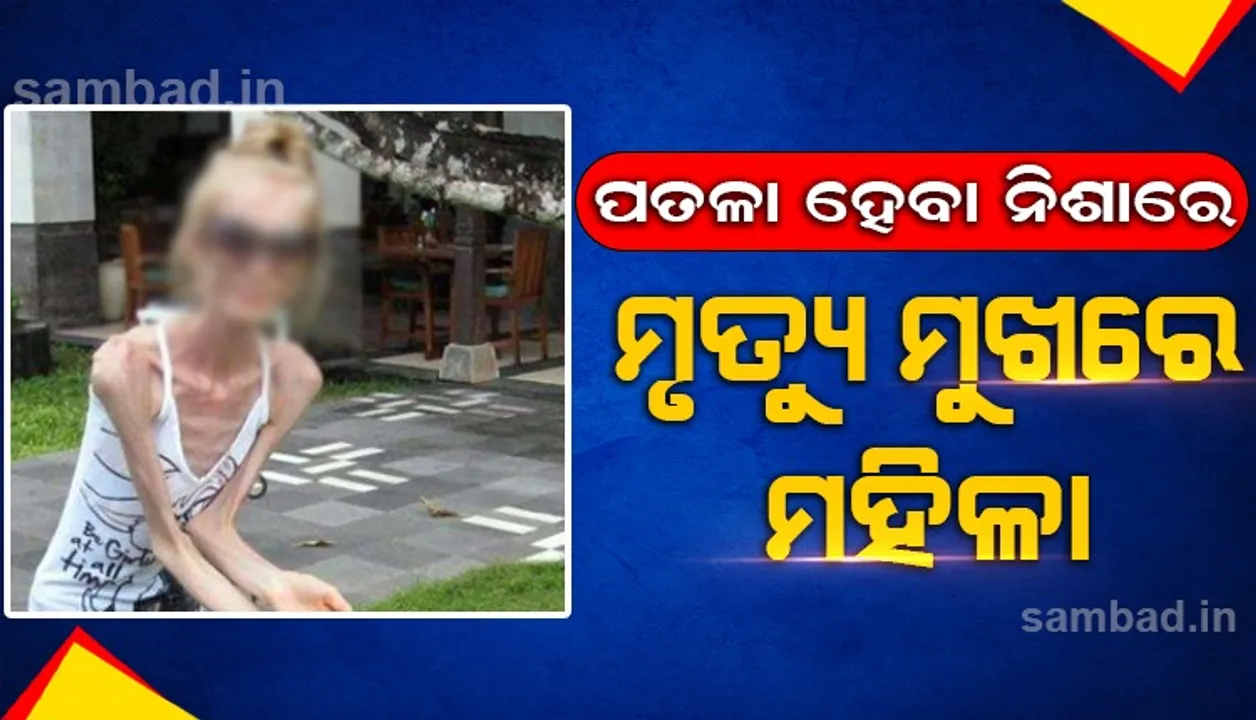  ଅତିରୁ ଇତି: ଅତ୍ୟଧିକ ଓଜନ ହ୍ରାସ କରି ମୃତ୍ୟୁ ମୁଖରେ ମହିଳା