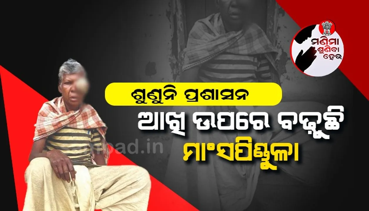  ବୃଦ୍ଧ ସୁରେନ୍ଦ୍ରଙ୍କ ଆଖି ଉପରେ ବଢୁଛି ମାଂସପିଣ୍ଡୁଳା; ପ୍ରଶାସନ ନିକଟରେ ଗୁହାରି ପରେ ମିଳିପାରୁନି ସ୍ବାସ୍ଥ୍ୟସେବା