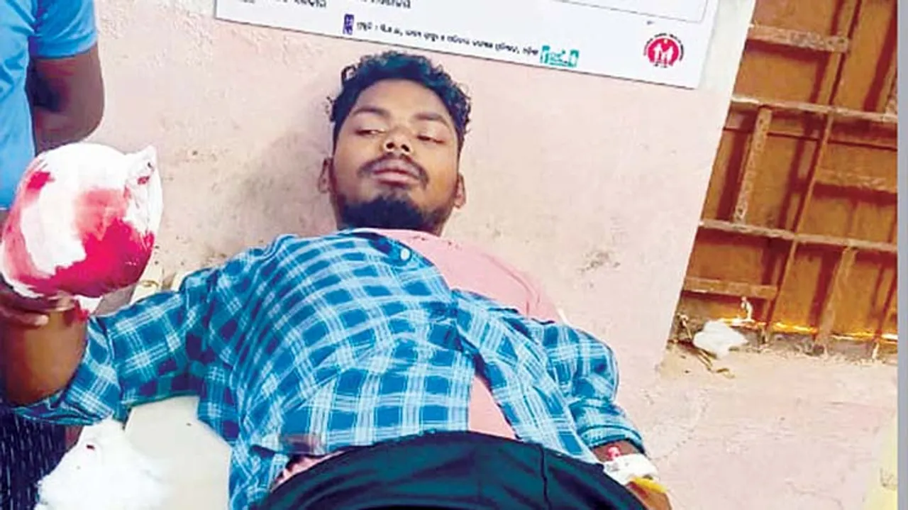  ଦେଶୀ ବନ୍ଧୁକରୁ ଗୁଳି ଫୁଟି ଯୁବକଙ୍କ ପାପୁଲି ଉଡ଼ିଲା 