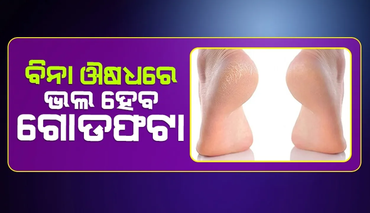  ଏହି ଘରୋଇ ଉପଚାର ଆପଣାନ୍ତୁ, ବିନା ଔଷଧରେ ଗୋଡଫଟାରୁ ମିଳିବ ମୁକ୍ତି