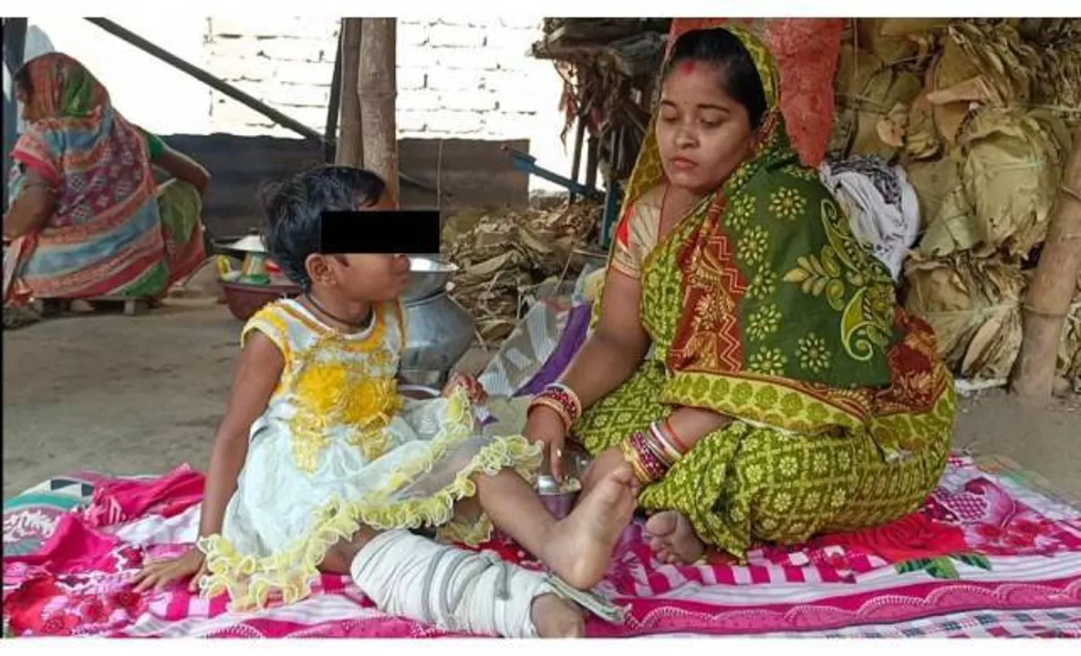  ଦୁର୍ଘଟଣା ଛଡ଼ାଇନେଲା ଖେଳକୁଦ; ବଞ୍ଚିବା ପାଇଁ ସଂଘର୍ଷ କରୁଛି ୮ ବର୍ଷର ଝିଅ ‘ଭୂମିକା’