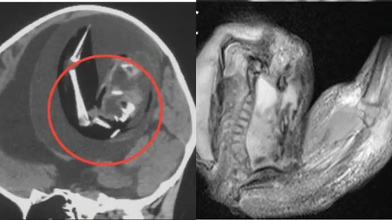  Image Courtesy of India Today 