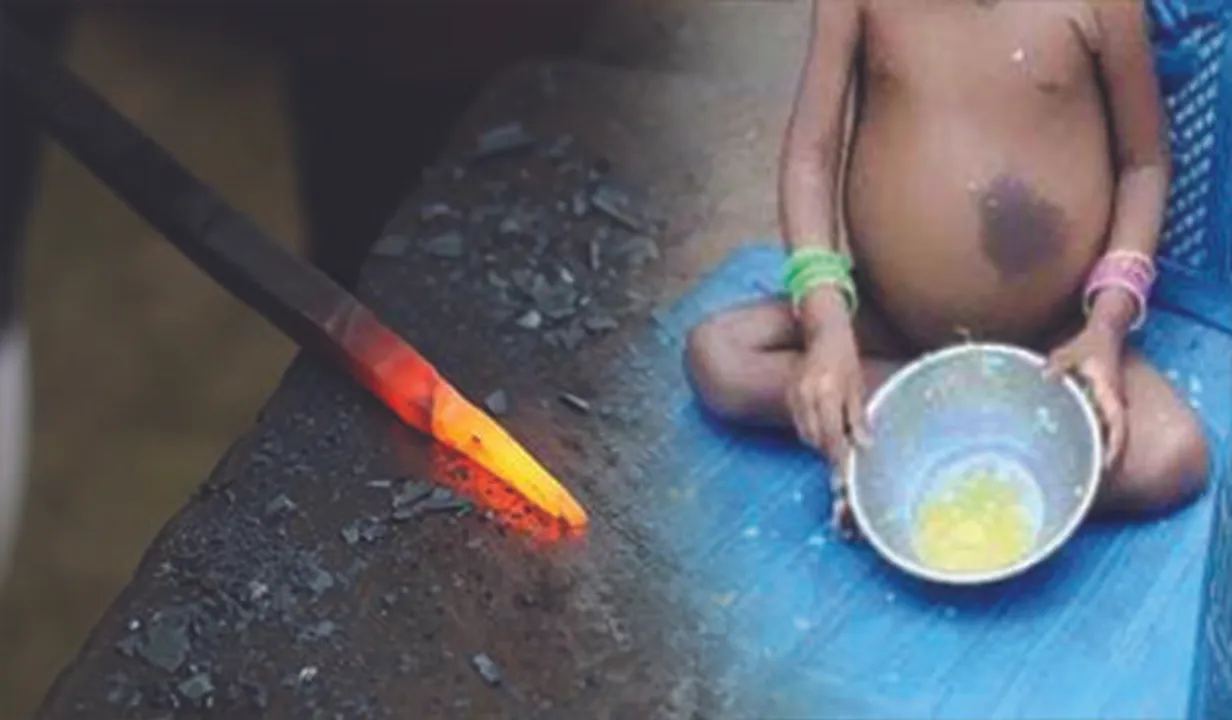  ଶିଳ୍ପାଞ୍ଚଳରେ ଅନ୍ଧବିଶ୍ବାସ: ଅପପୁଷ୍ଟିର ଶିକାର ଶିଶୁକୁ ଚେଙ୍କ
