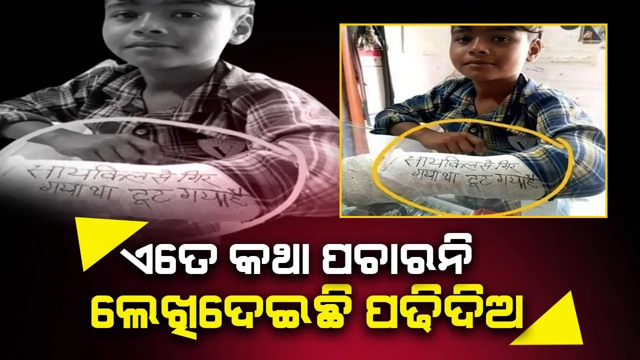  ହାତ କେମିତି ଭାଙ୍ଗିଲା ଶୁଣି ଶୁଣି ବିରକ୍ତ ହେବା ପରେ ମୁଣ୍ଡକୁ ଆସିଲା ଏହି ବୁଦ୍ଧି