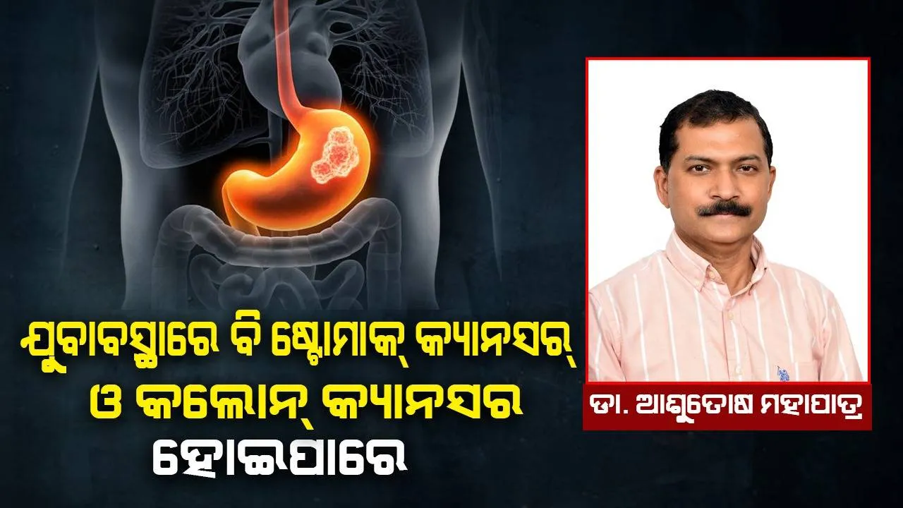  ଅତ୍ୟାଧୁନିକ ଉପକରଣ ଦ୍ୱାରା ଷ୍ଟୋମାକ୍ କ୍ୟାନ୍‌ସର୍‌ ଓ କଲୋନ୍ କ୍ୟାନ୍‌ସର୍‌ର ଉପଯୁକ୍ତ ଚିକିତ୍ସା ସମ୍ଭବପର