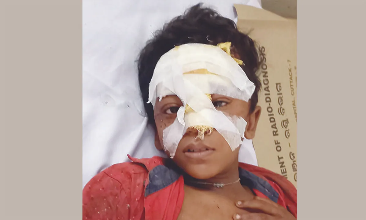  ୧୦ ବର୍ଷ ବାଳକର ଲୋମଟାଙ୍କୁରା କାହାଣୀ...: ୧୦ ଜଣଙ୍କ ତଳେ ଚାପି ହୋଇଯାଇଥିଲି