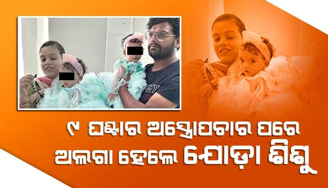  ପୁଣି ଚମତ୍କାର କଲେ ଏମ୍ସ ଡାକ୍ତର: ୯ ଘଣ୍ଟାର ଅସ୍ତ୍ରୋପଚାର କରି ପେଟ ଓ ଛାତି ଲାଗିଥିବା ଯୋଡ଼ା ଶିଶୁଙ୍କୁ ଅଲଗା କଲେ