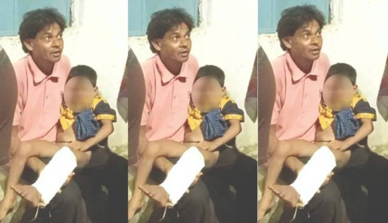  ଶିକ୍ଷକଙ୍କ ମାଡ଼ରେ ୪ ବର୍ଷ ଶିଶୁର ଗୋଡ଼ ଭାଙ୍ଗିଲା