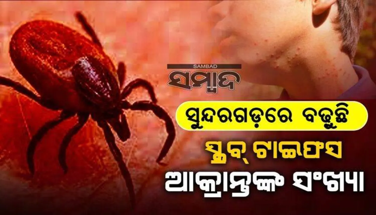  ପୁଣି ଦିନକରେ ସୁନ୍ଦରଗଡ଼ରେ ୭ ସ୍କ୍ରବ୍ ଟାଇଫସ ଚିହ୍ନଟ: ଆକ୍ରାନ୍ତଙ୍କ ସଂଖ୍ୟା ୩୯୬ରେ ପହଞ୍ଚିଲା