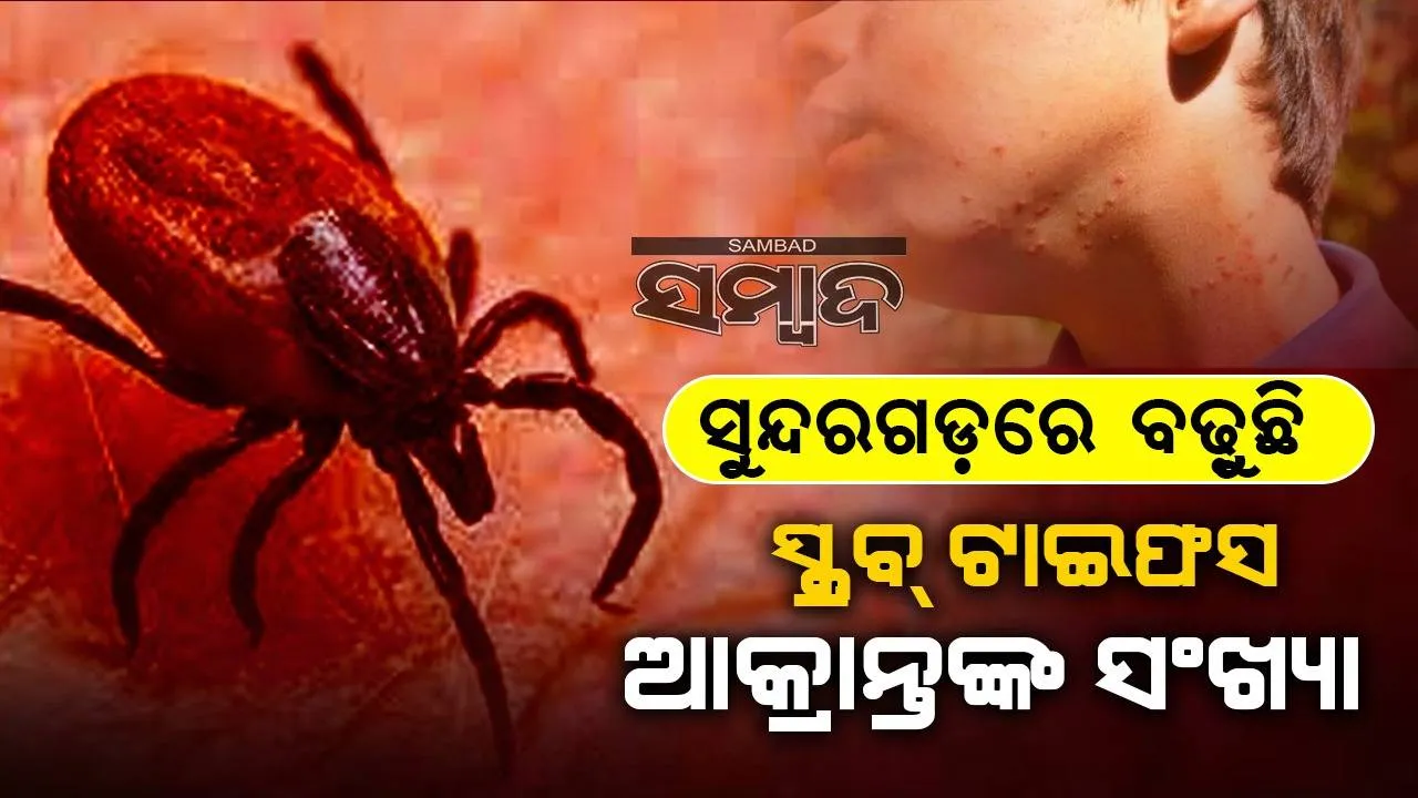  ଚିନ୍ତା ବଢ଼ାଇଲାଣି ସ୍କ୍ରବ୍ ଟାଇଫସ: ସୁନ୍ଦରଗଡ଼ରେ ପୁଣି ୧୬ ପଜିଟିଭ ଚିହ୍ନଟ