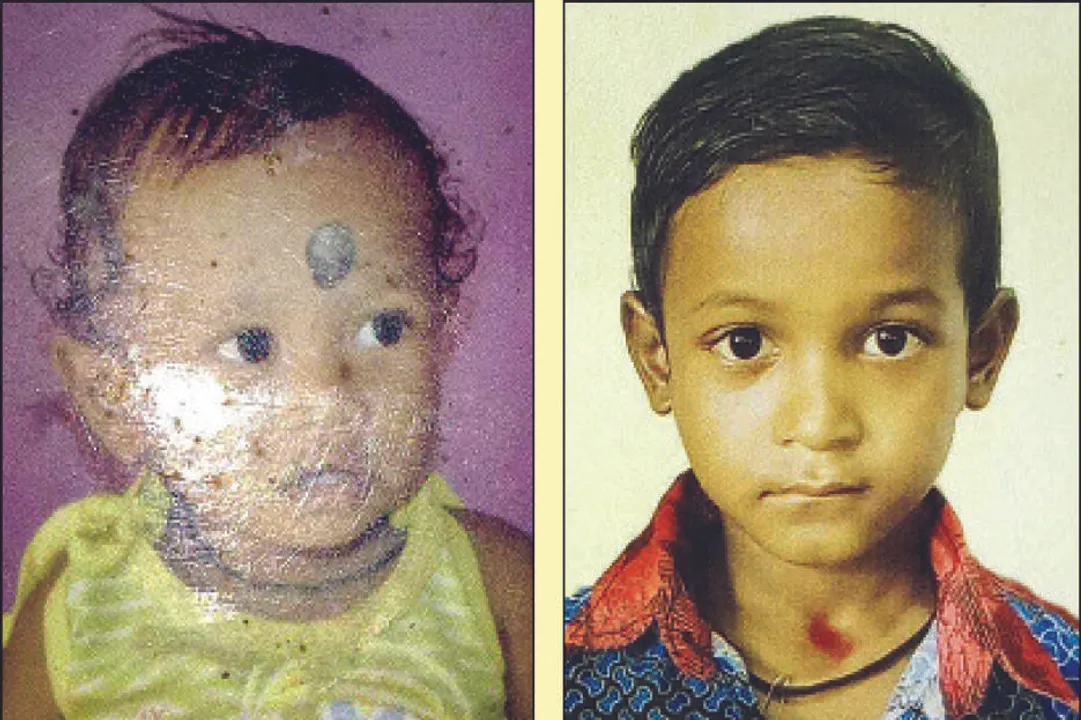  ଏମିତି ବି ଆସେ ମୃତ୍ୟୁ: ଖେଳିବାକୁ ଯାଇ କୂଅରେ ପଡ଼ିଗଲେ ୨ ଭାଇ