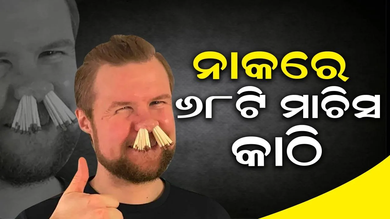 ନାକପୁଡ଼ାରେ ଏକାଥରକେ ୬୮ଟି ମାଚିସ କାଠି ପୁରାଇଥିବା ବ୍ୟକ୍ତିଙ୍କ ପ୍ରତିକ୍ରିୟା