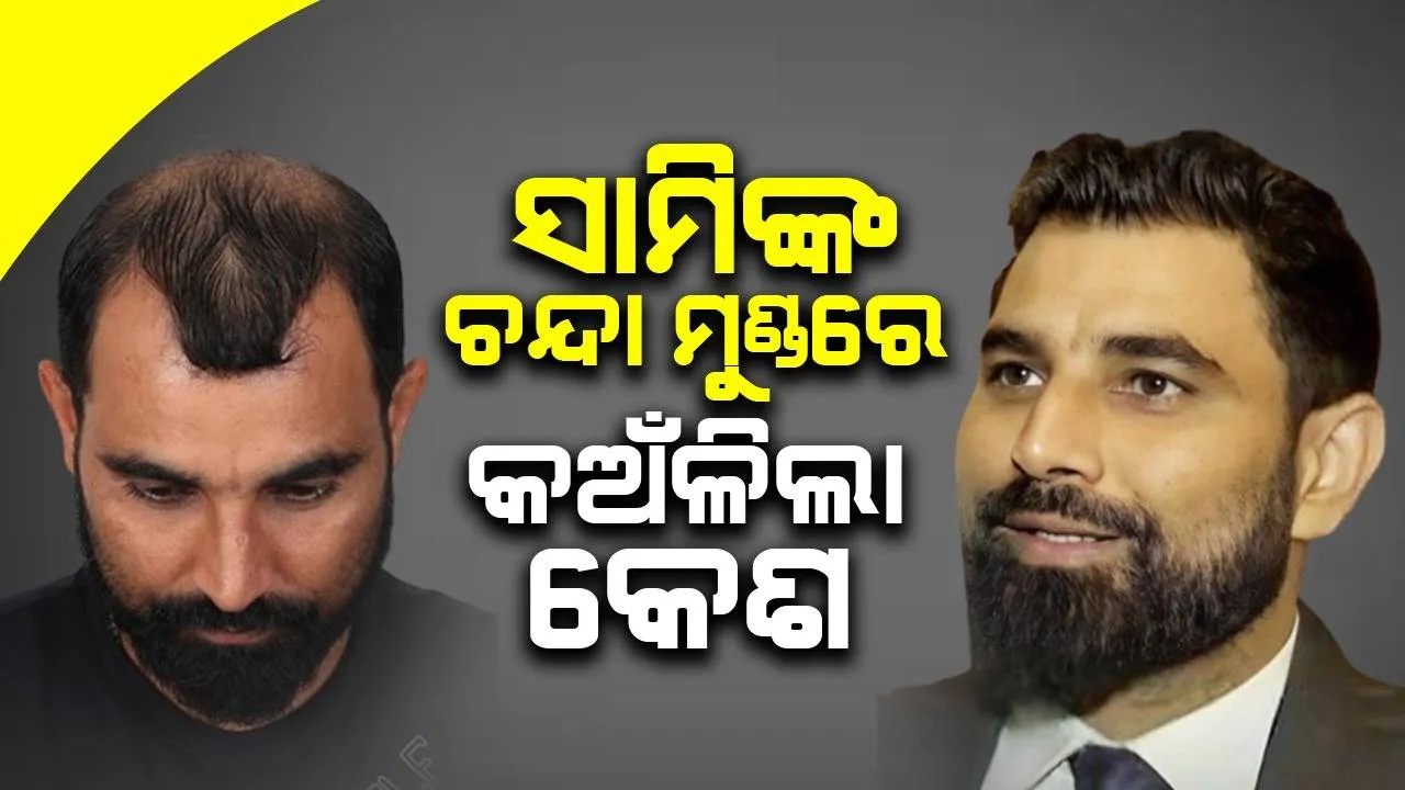  ଚନ୍ଦା ମୁଣ୍ଡରେ କେଶ କଅଁଳିବା ଘଟଣାକୁ ନେଇ ସାମିଙ୍କ ପ୍ରତିକ୍ରିୟା