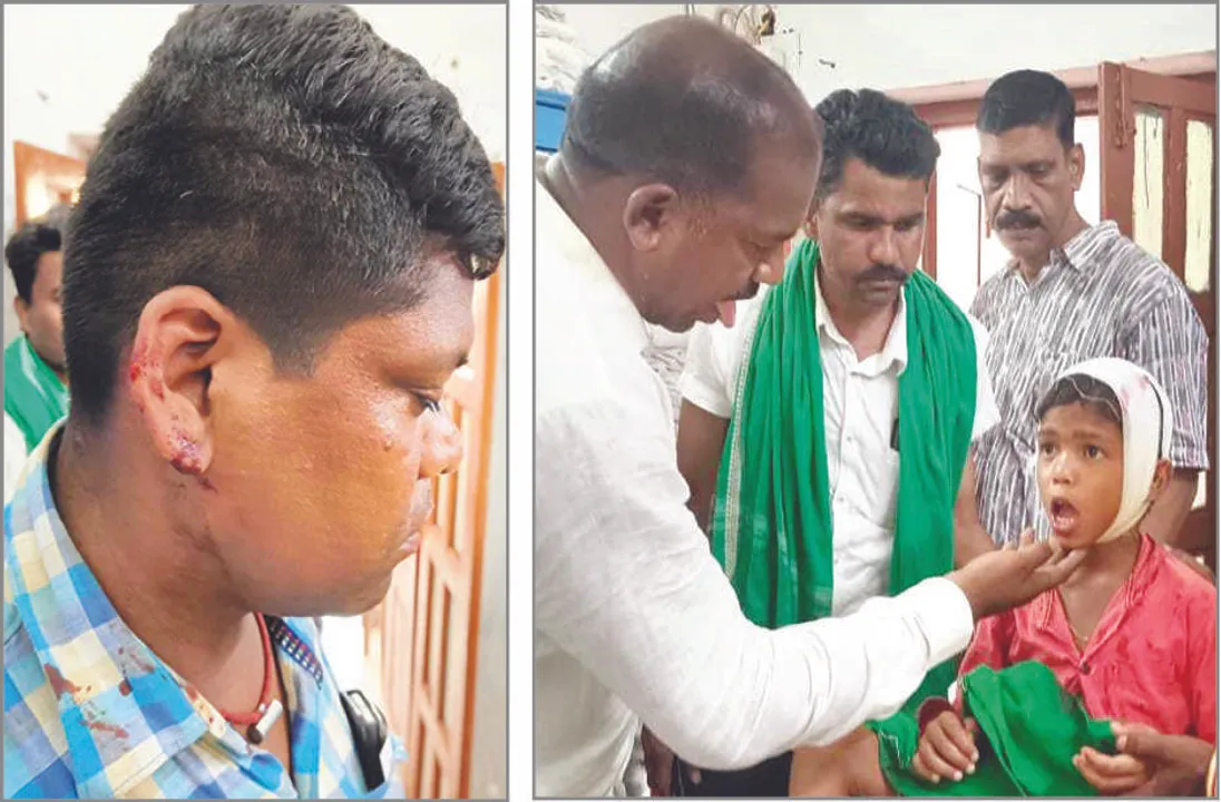  ପଥରମାଡ଼ରୁ ବର୍ତ୍ତିଗଲେ ବିଧ‌ାୟକ ପ୍ରାର୍ଥୀ
