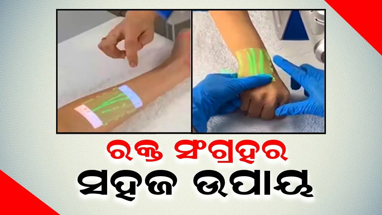 ରକ୍ତ ସଂଗ୍ରହ ସମୟରେ ରୋଗୀଙ୍କ ଶିରା ଖୋଜିବାର ସହଜ ଉପାୟ: ଆନନ୍ଦ ମହିନ୍ଦ୍ରା ସେୟାର କଲେ ଭିଡିଓ