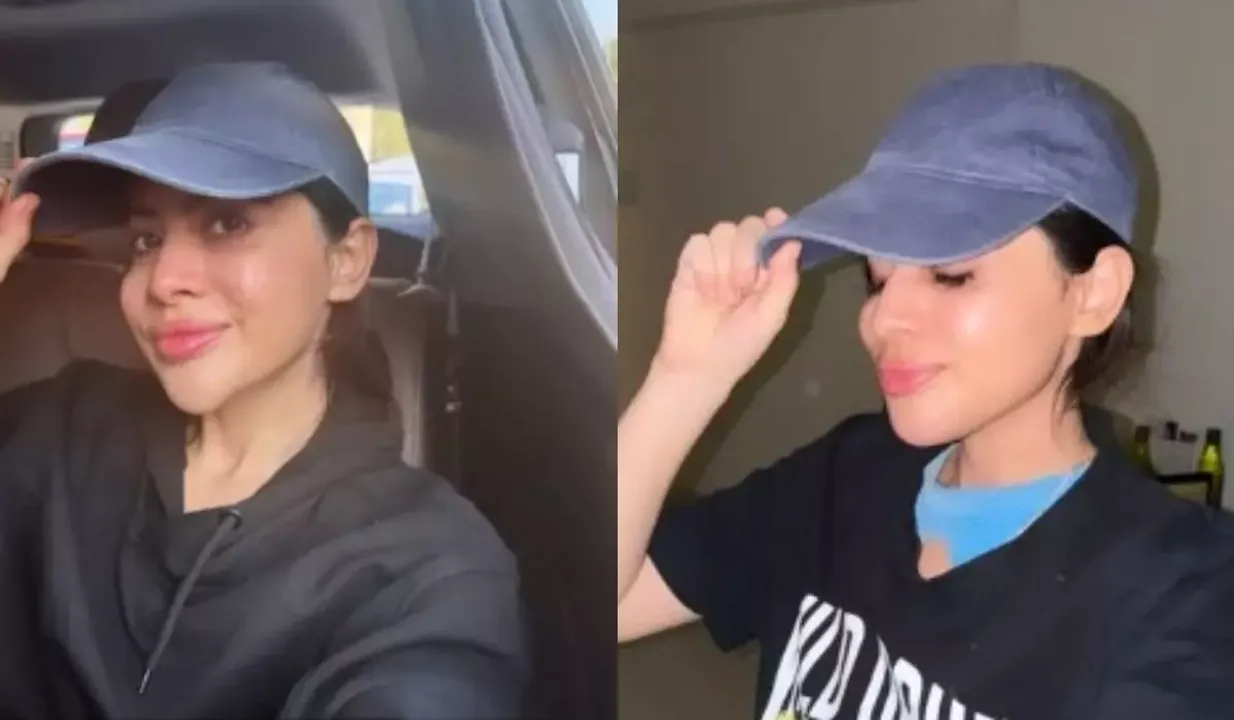 Uorfi Javed Shares Decision To Dissolve Chin Fillers, See Before-After