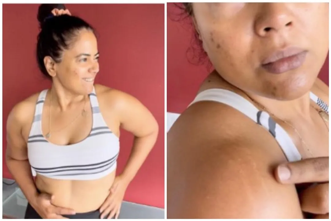Sameera Reddy flaunts stretch marks, Sameera Reddy flaunts stretch marks