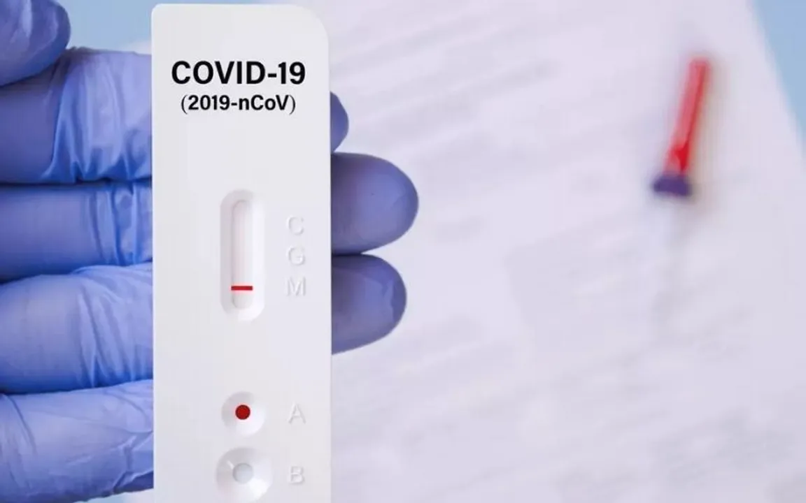 new coronavirus variant omicron, Doctor Infected With Two Variants, Abbott COVID-19 Home Test Kit, COVID-19 delta variant, Delta Plus Variant Of Novel Coronavirus, RAT Kit For COVID-19 Self Testing, COVID-19 Self Testing, Rapid Antigen Test