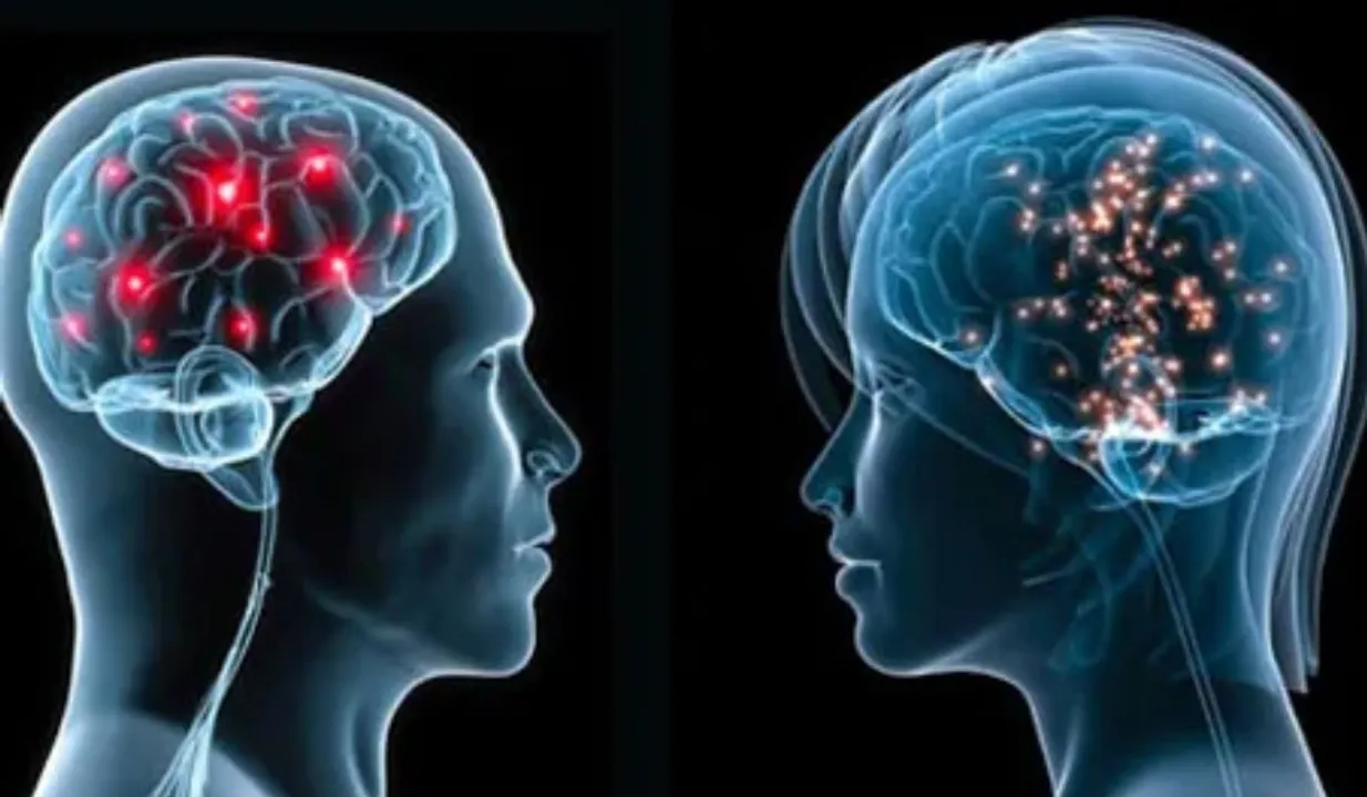 Women's Brain Shrink