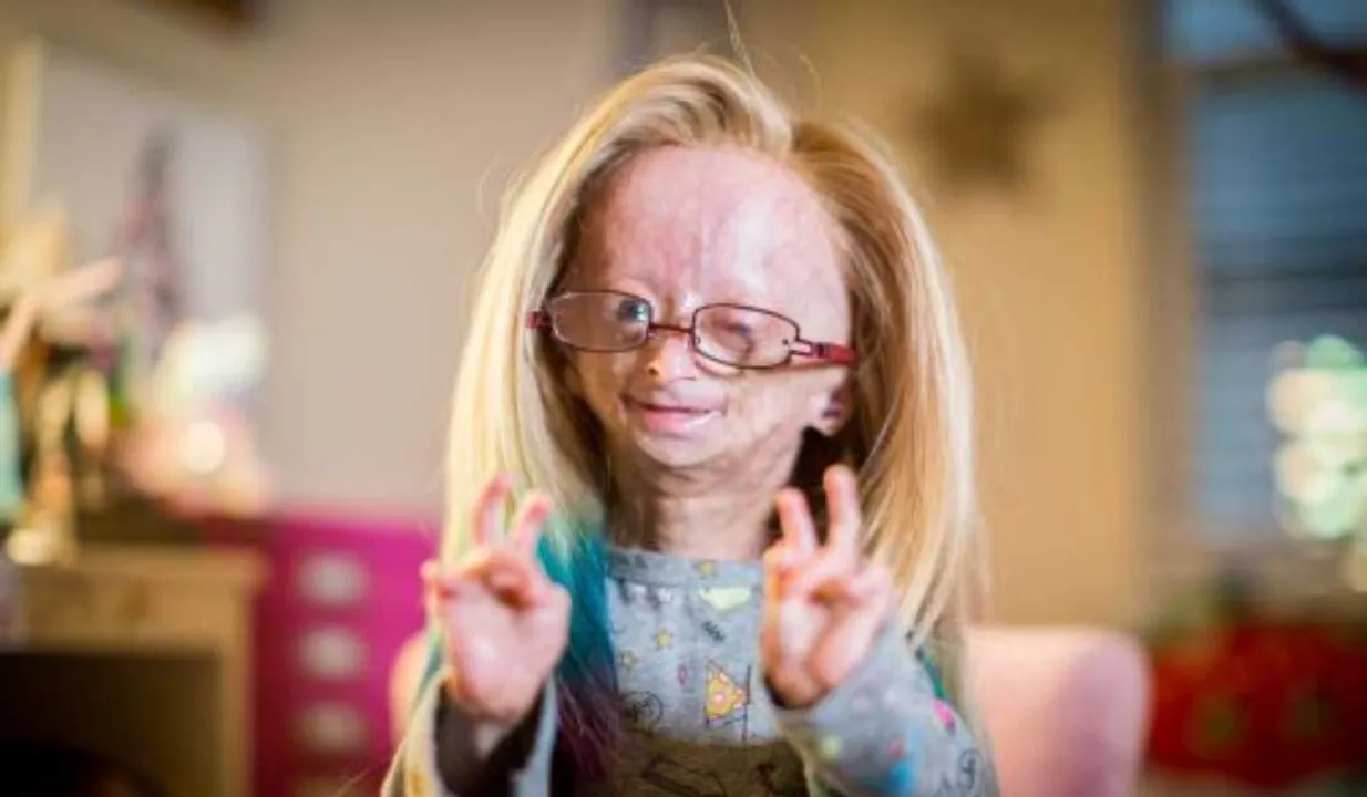 Adalia Rose Williams