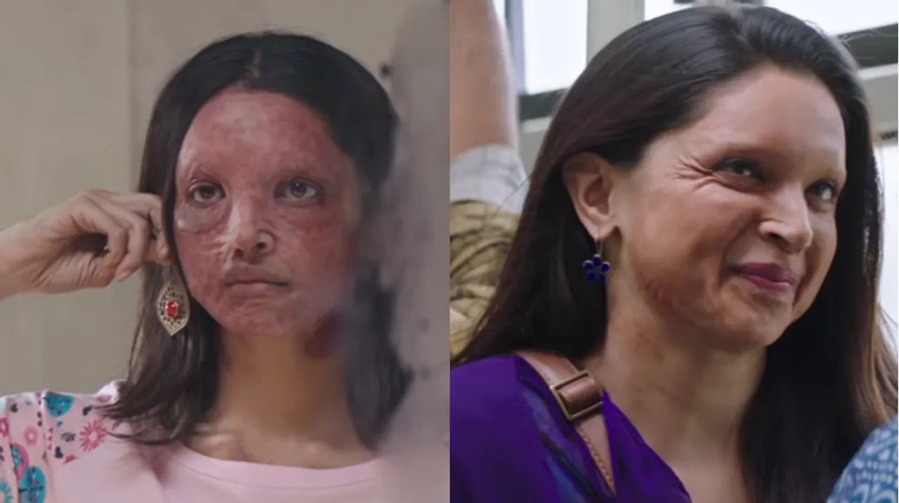 Chhapaak trailer