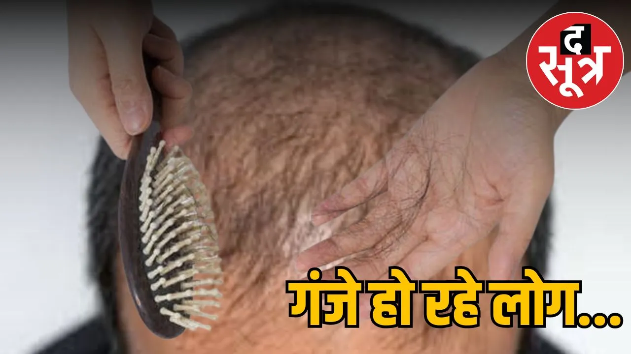 hair loss baldness