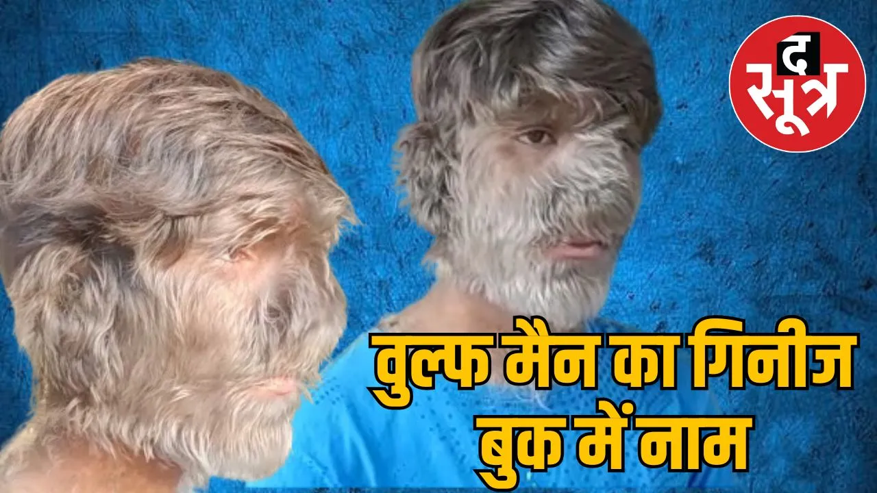 world-record-wolf-man
