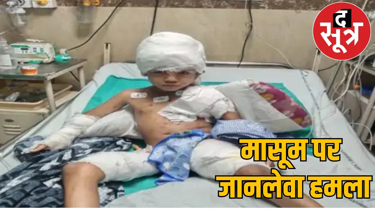 Street Dog Attack Raipur the sootr