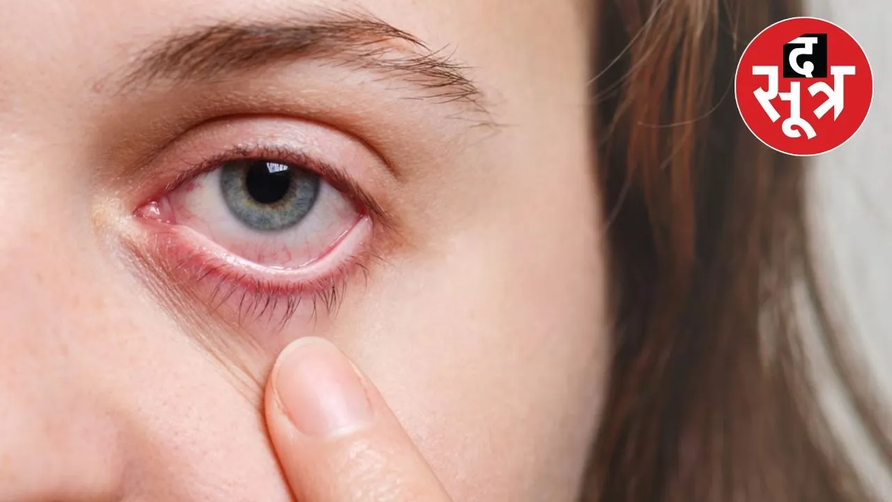 glaucoma-symptoms-detect-early-vision-loss