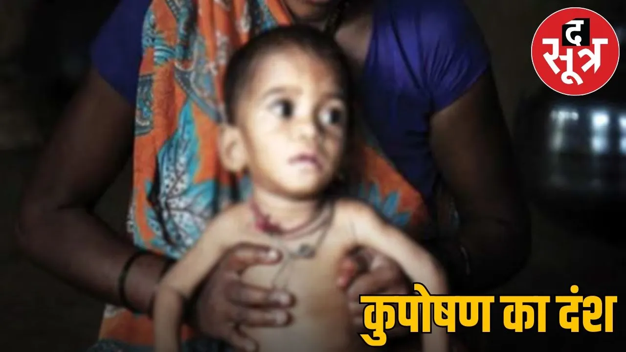 Picture of malnutrition in Madhya Pradesh
