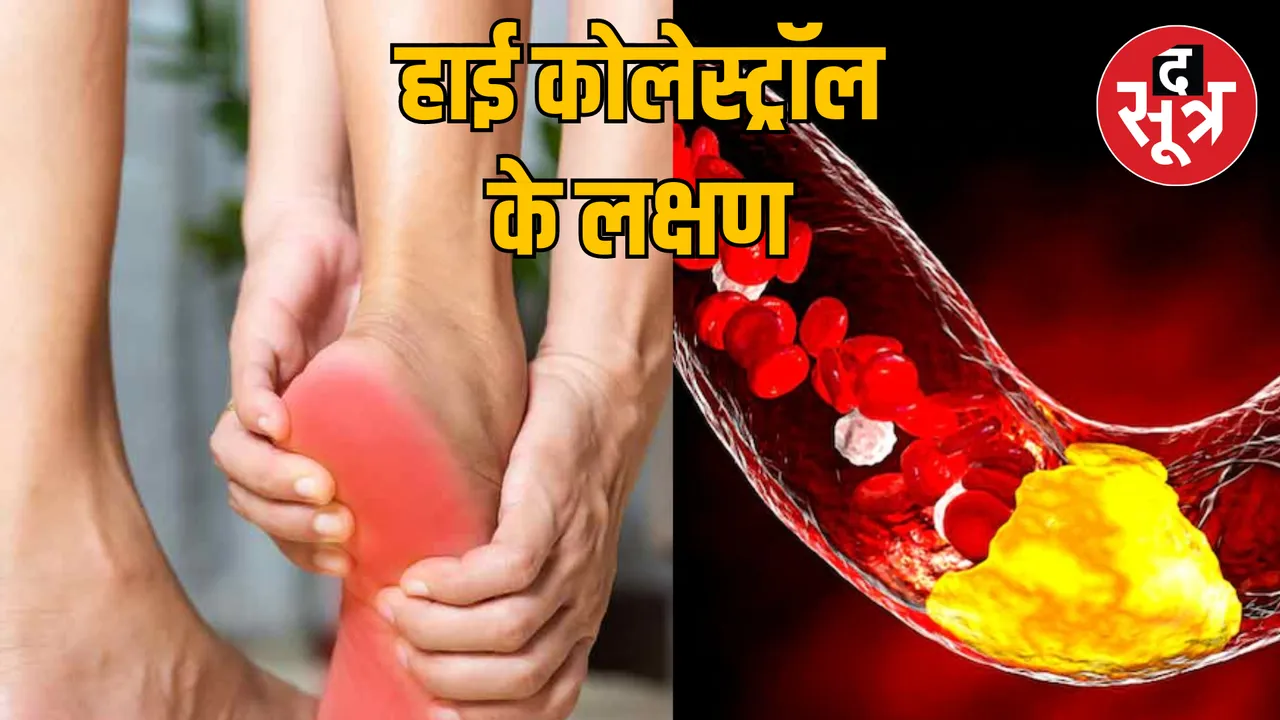 5 symptoms appear feet when cholesterol increases