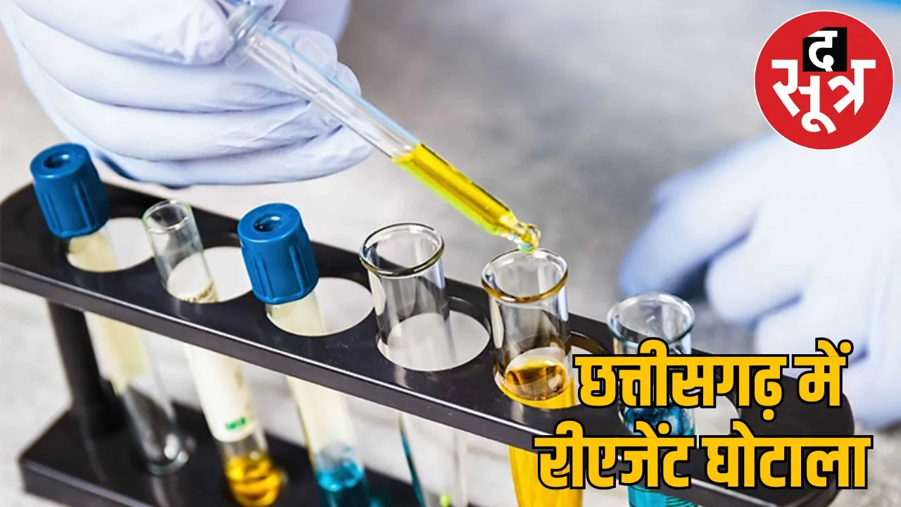 Urine box worth 66 rupees bought 23 thousand