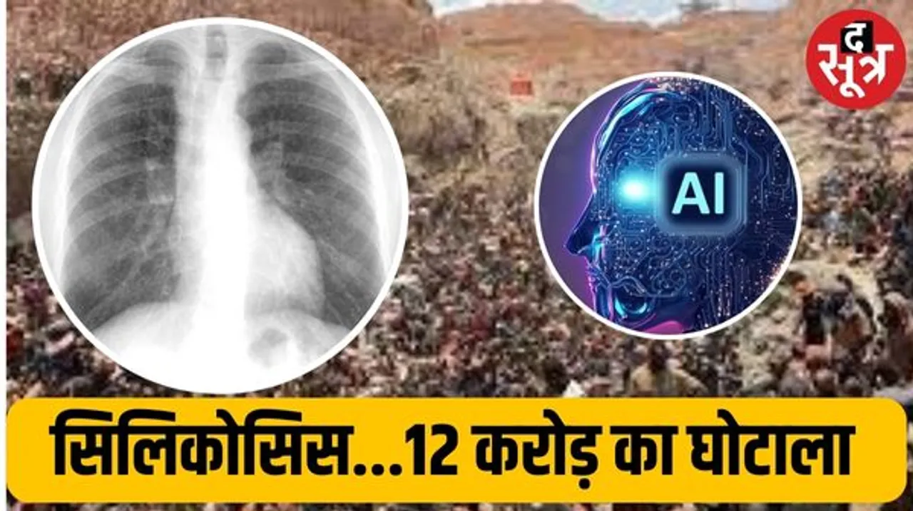 सिलिकोसिस मरीजों के नाम पर बड़ा फर्जीवाड़ा, फर्जी एक्सरे रिपोर्ट लगा कर 12 करोड़ से ज्यादा का भुगतान, AI से पकड़ में आया मामला