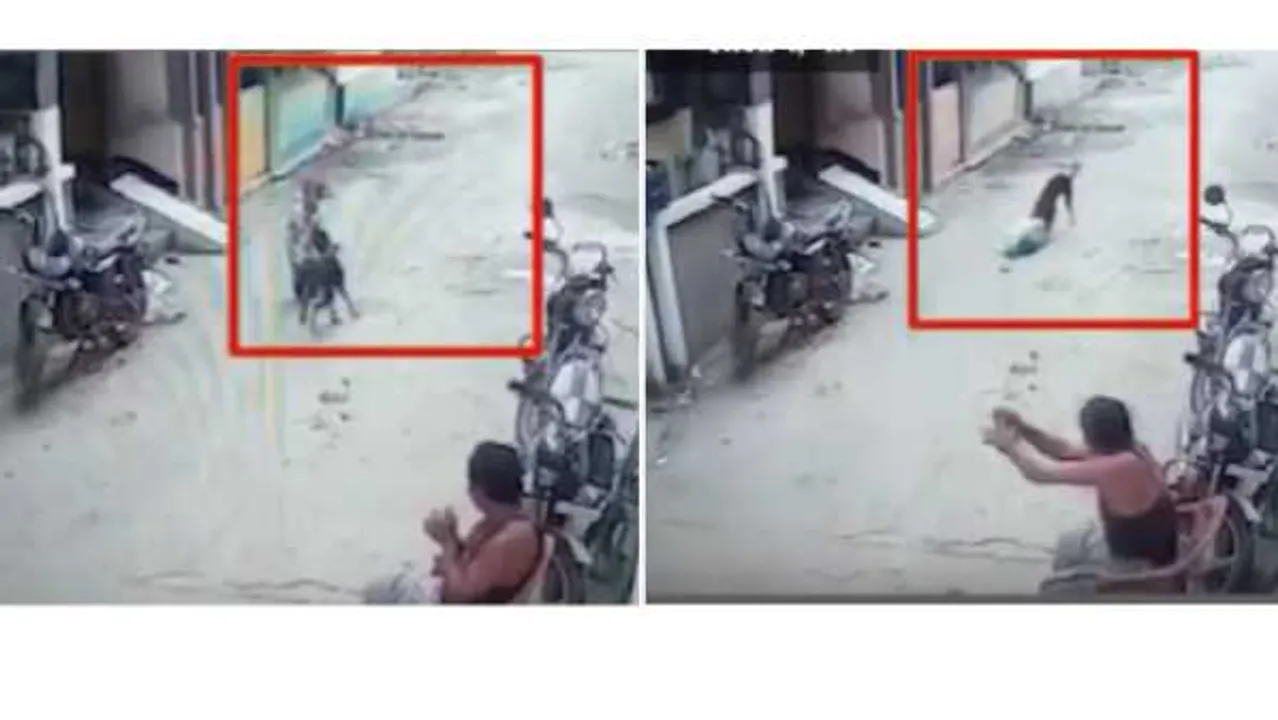 जाको राखे साइयां: 4 साल की बच्ची की गर्दन मुंह में दबाकर घसीटता रहा कुत्ता, ऐसे बची जान