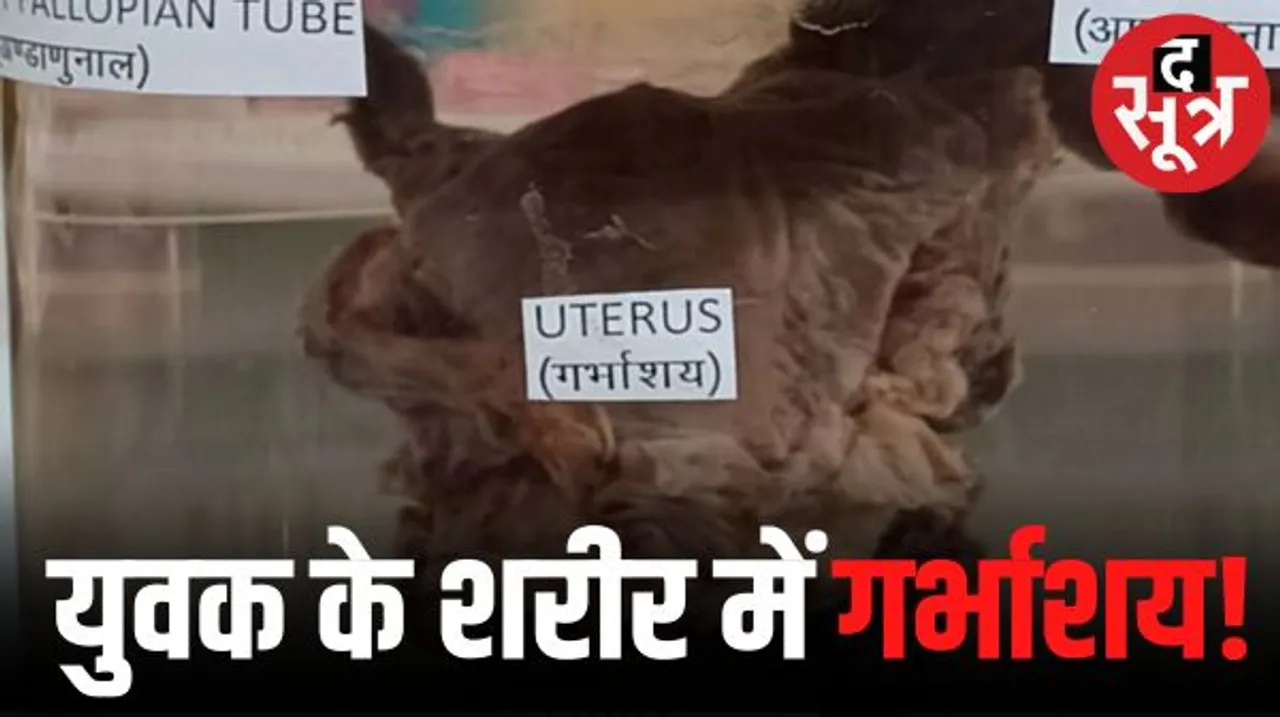 युवक के पेट में महिलाओं जैसा गर्भाशय, डॉक्टरों ने किया सफल ऑपरेशन, दुनिया में बहुत कम मिलते हें ऐसे मामले