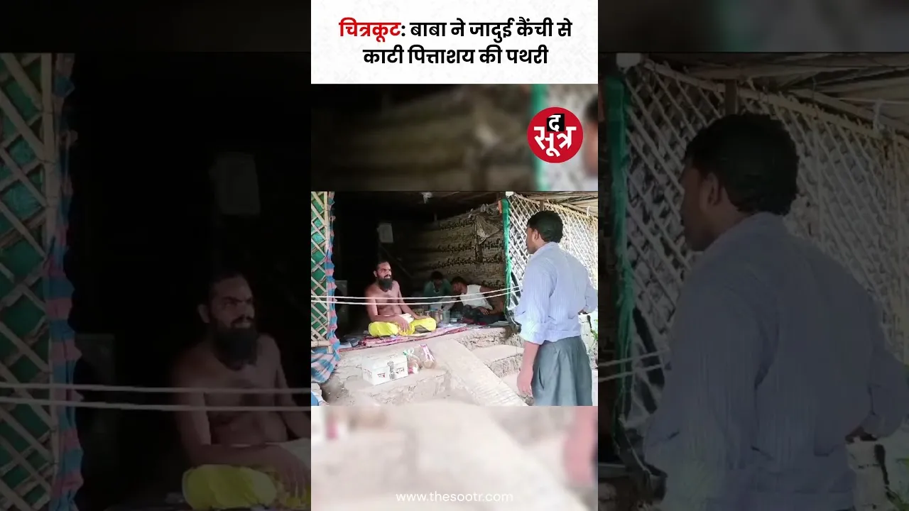 चित्रकूट के बाबा हनुमान दास ने जादुई कैंची से का*टी पित्ताशय की पथरी, देखें वीडियो #shorts