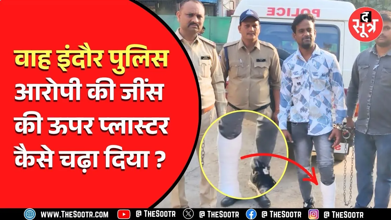 Indore Police ने फिर गजब ही कर डाला, आरोपी के पैर में जींस के ऊपर चढ़वाया प्लास्टर