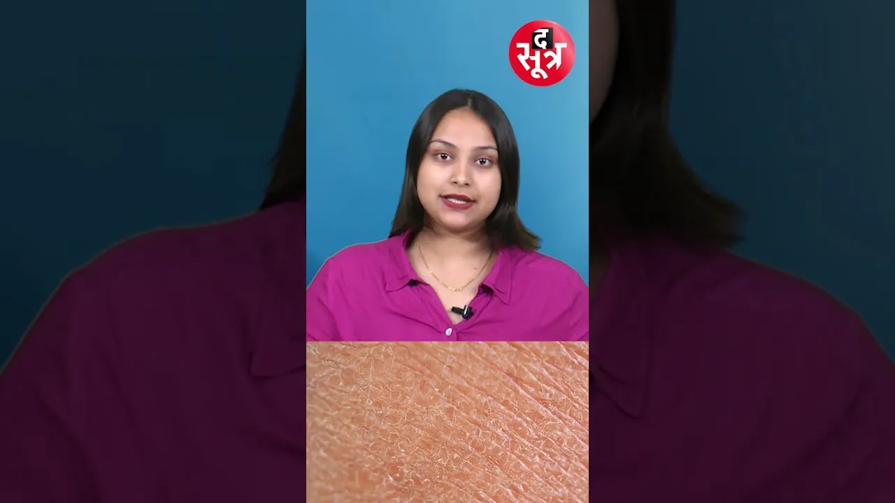 अगर आप भी सर्दियों में गरम पानी से नहाते हैं तो जान लीजिए इसके नुकसान