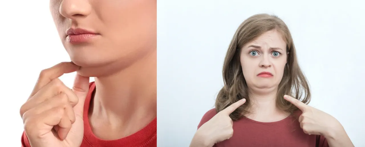 Double chin