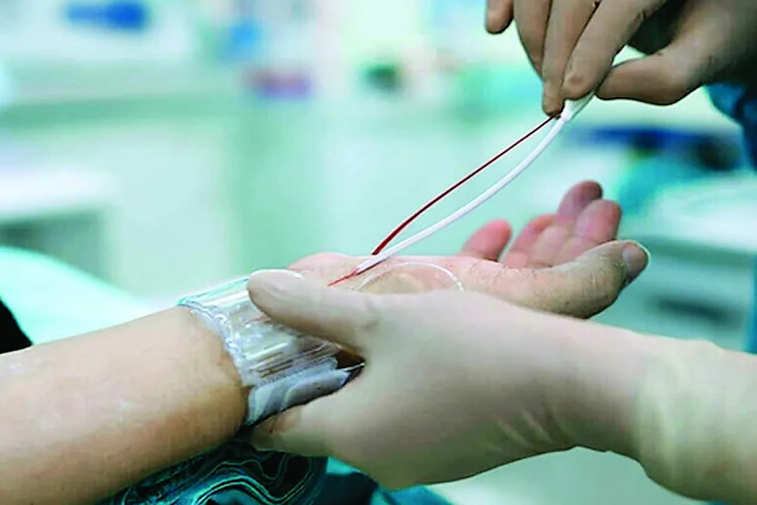  दिल की सेहत के लिए क्यों जरूरी है एंजियोग्राफी: जानिए प्रक्रिया, फायदे और सावधानियां 